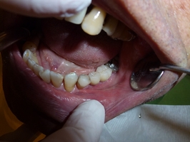 Оферти за избелване на зъби 8