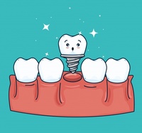 зъбен мост - 34975 - още за нашите продукти
